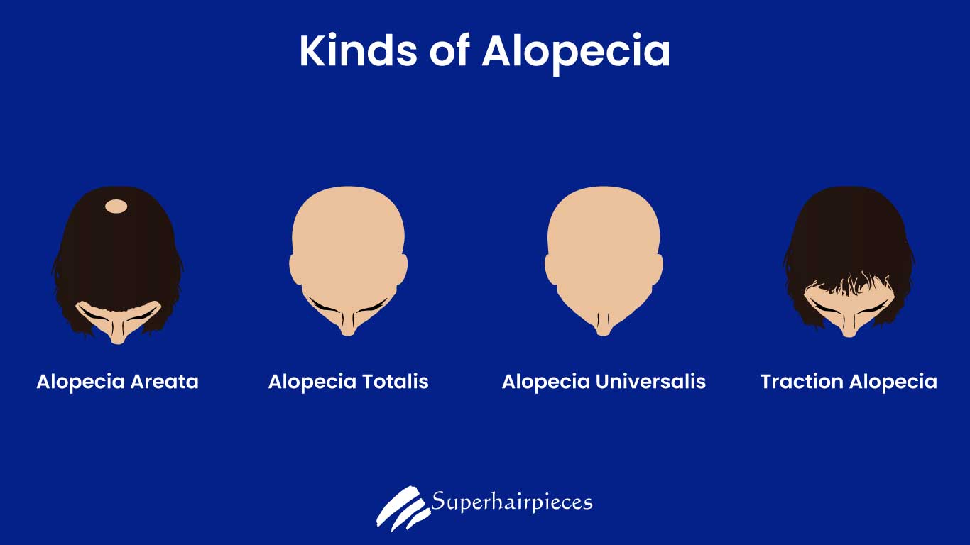 Alopecia