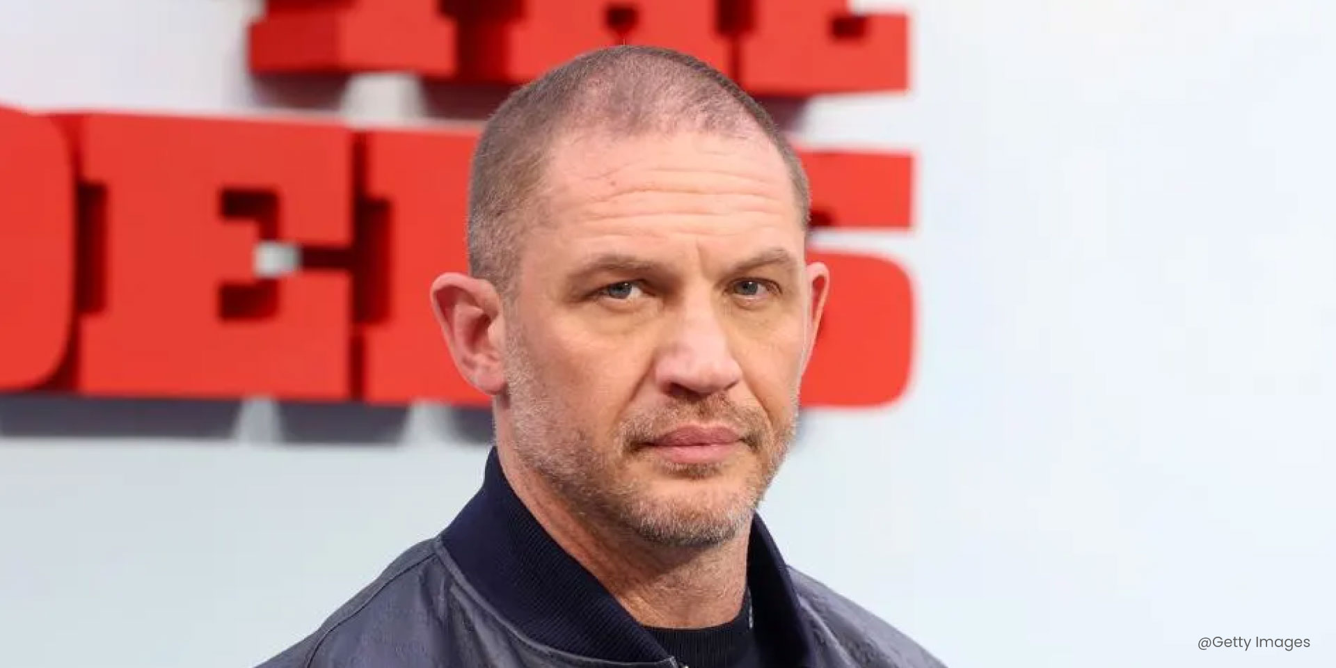 tom hardy thin hair